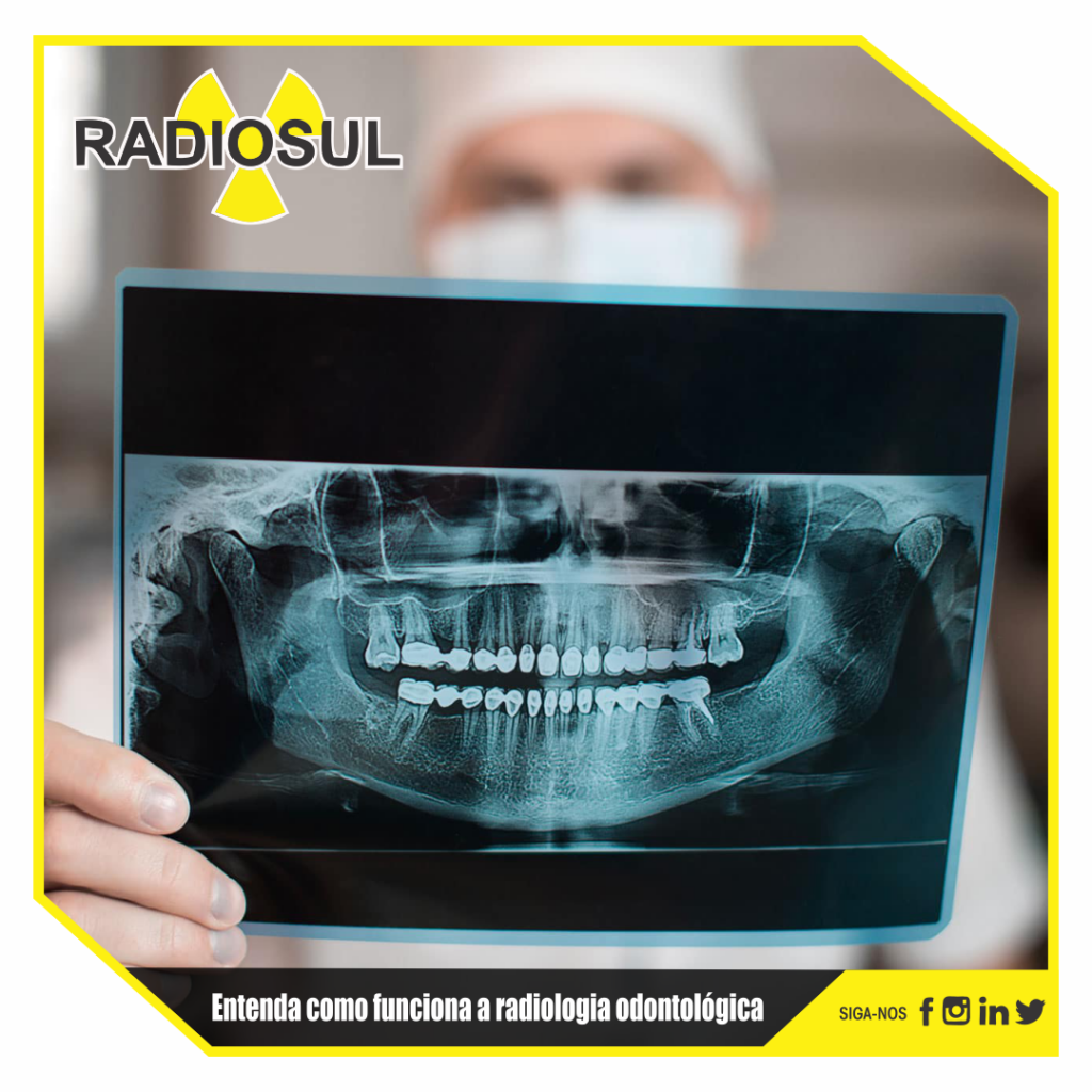 RadioSul Digital Entenda como funciona a radiologia odontológica