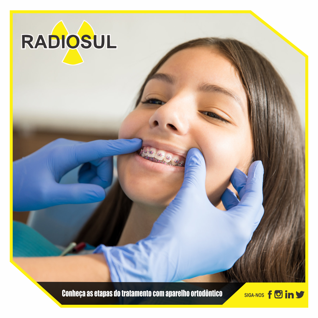 RadioSul Digital  Conheça as etapas do tratamento com aparelho ortodôntico