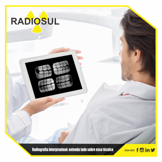 RadioSul Digital | Radiografia Interproximal: Entenda Tudo Sobre Essa ...